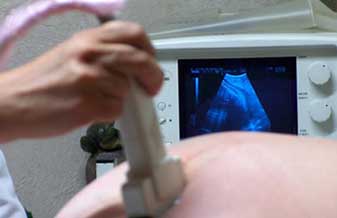 Gildete Rodrigues De Souza - Foto 1